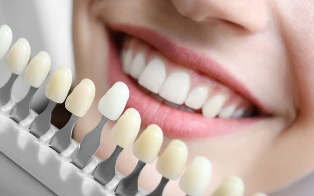 Woman at her professional teeth whitening appointment in North Ridgeville OH